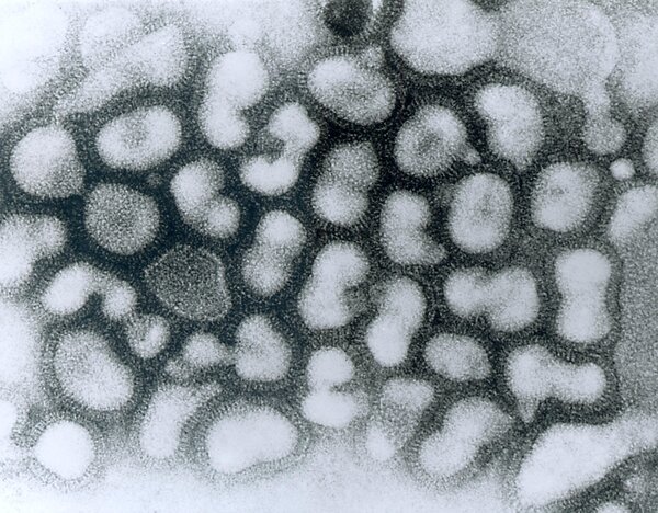 Avires Influenza-Virus (HPAIV), Auslser der Geflgelpest